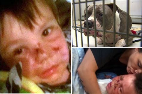 pitbull dog attack child